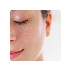 Espuma Iluminadora Ottie Fruit Yogurt Foam Cleanser Strawberry