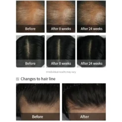 La'dor Dermatical Hair-Loss Shampoo - Champú Anticaida