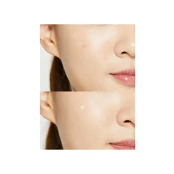 Parche Anti Acné COSRX Acne Pimple Master Patch