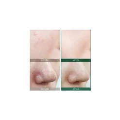 Serum Equilibrante Piel Grasa Some By Mi AHA BHA PHA 30 Days Miracle Serum